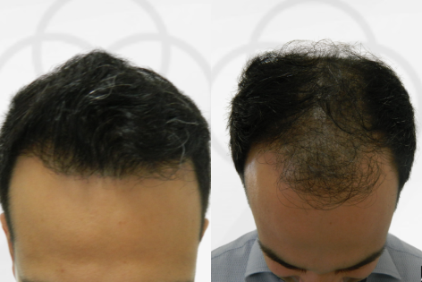 Antes e Depois Dr. Paulo 3