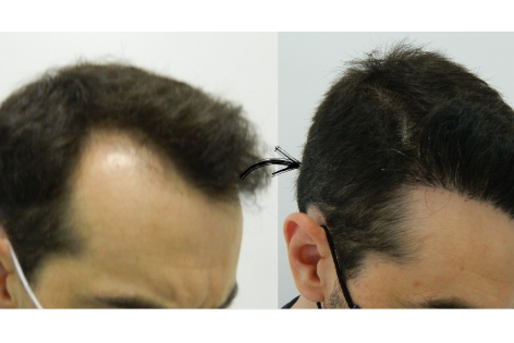 Antes e Depois Dr. Paulo 9 2x